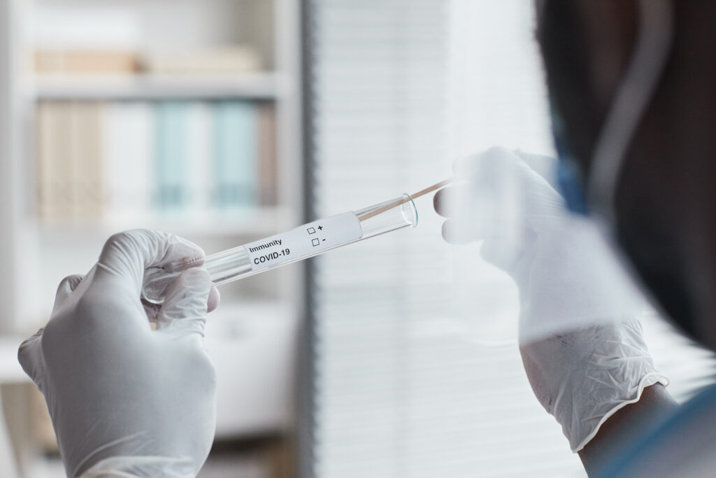 Close-up of doctor in protective gloves holding test tube for analysis of covid. (Foto: banco de imagens)