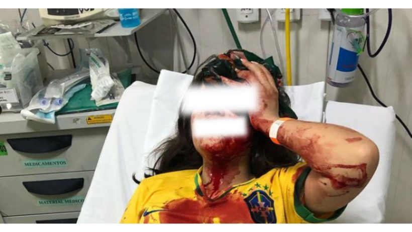 Adolescente de 13 anos é atingida por pedrada durante carreata pro-Bolsonaro em Fortaleza