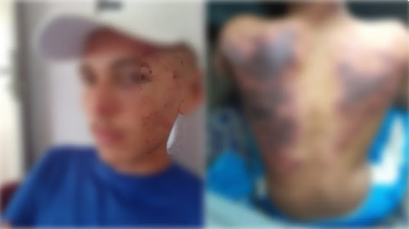 Dupla é agredida por criminosos quando iam jogar futsal. Foto: Arquivo Pessoal