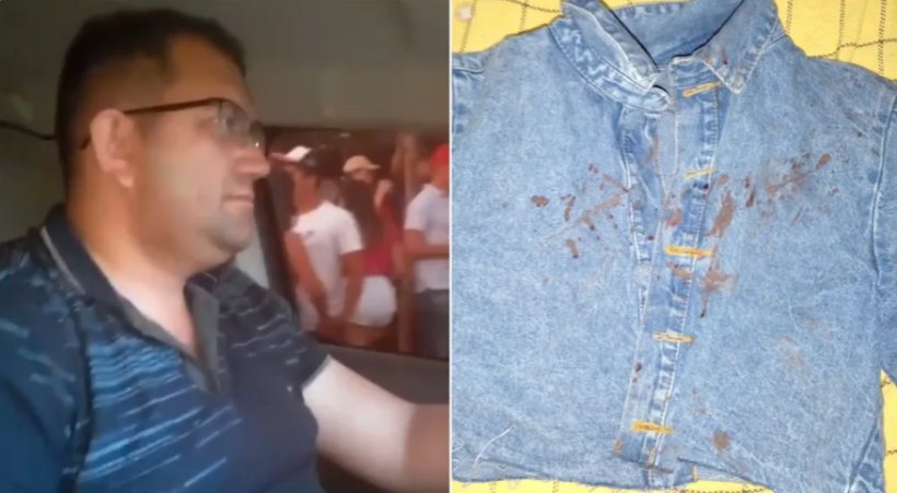 Mulher denuncia PM após ser espancada em Canindé
