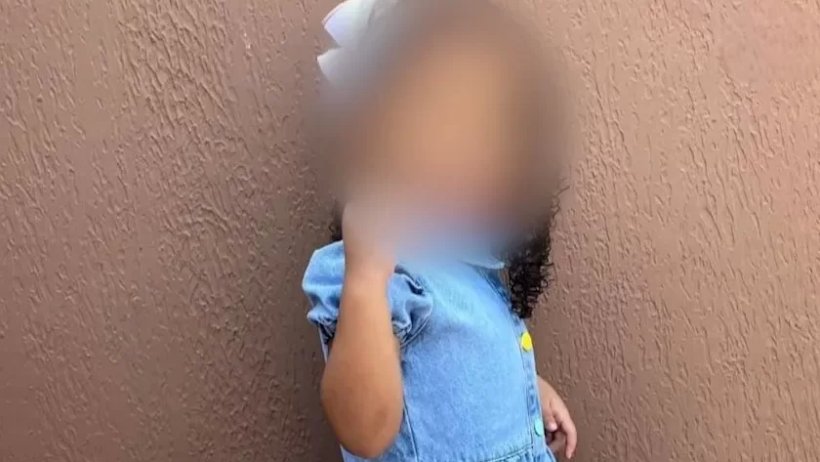 Criança de 4 anos baleada na cabeça passa por cirurgia para retirada de projétil
