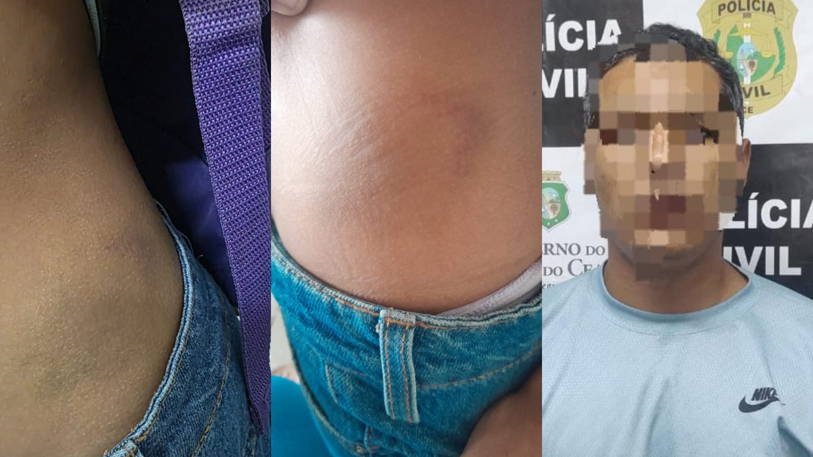 Em Cascavel: Polícia prende padrasto que torturava e ameaçava enteada de 8 anos
