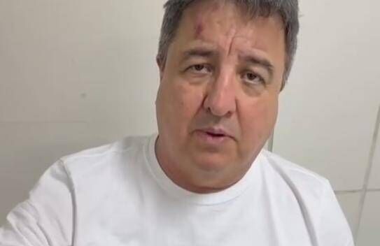 Danilo Forte sofre acidente em São José de Solonópole