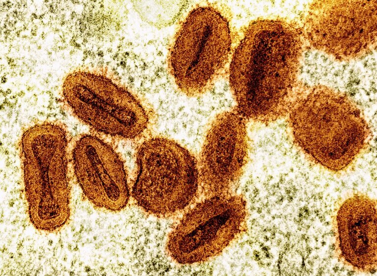 Ceará confirma terceiro caso de Mpox em 2026, aponta plataforma Integra SUS